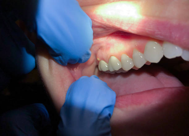 Best Emergency Dentist for Knocked-Out Tooth in Flemington, NJ